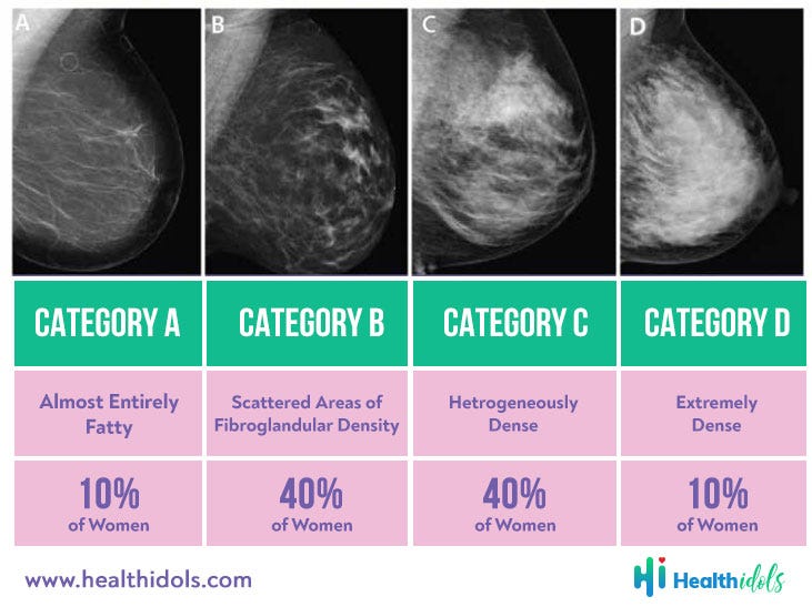 How Breast Density Effect To Breast Cancer Health Idols By Anna S Medium