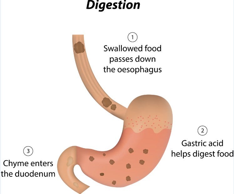 Digestive Specialist Hialeah — Digestive Medicine Associates (305) 822