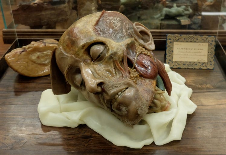 The Sculptor Who Changed Anatomy. Gaetano Zumbo is credited with the