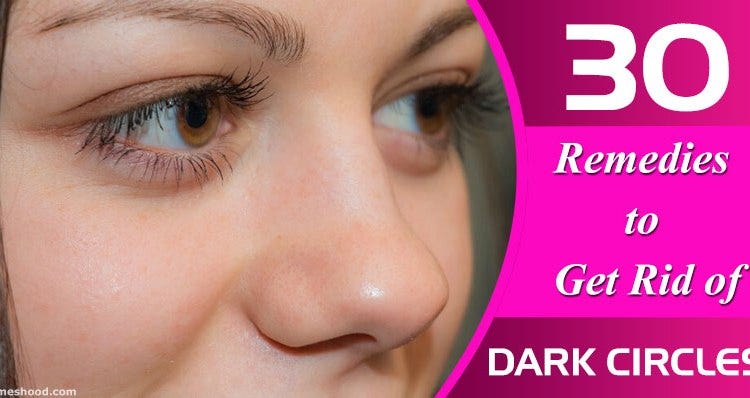dark marks under eyes remedies
