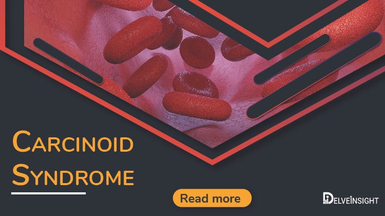 https://www.delveinsight.com/report-store/carcinoid-syndrome-market
