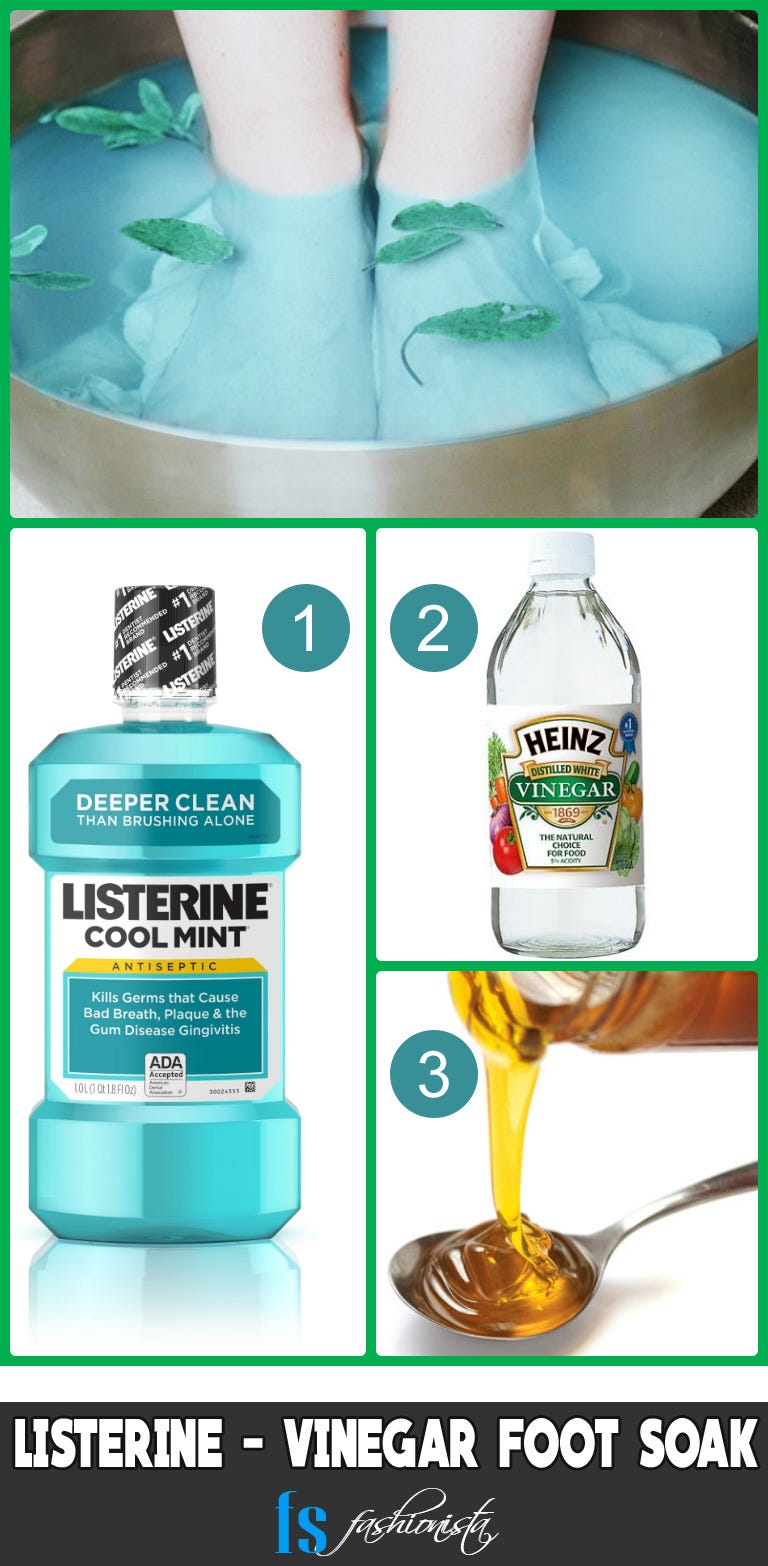 listerine soak for cracked heels