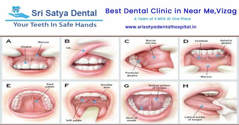 What Should You Know About Oral Cancer
