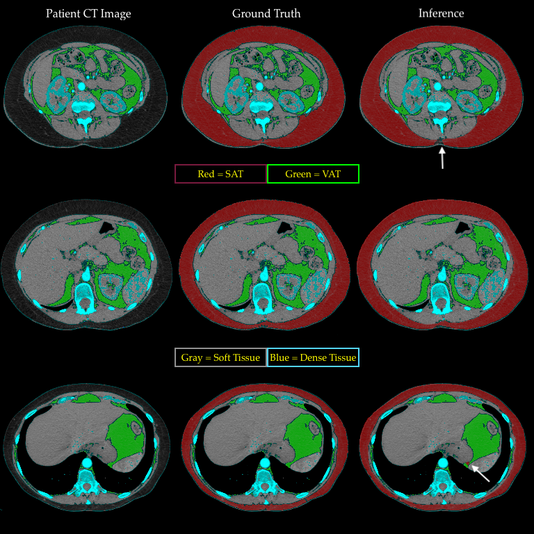 Deep Learning In Medical Imaging VI By Nigel M Parsad