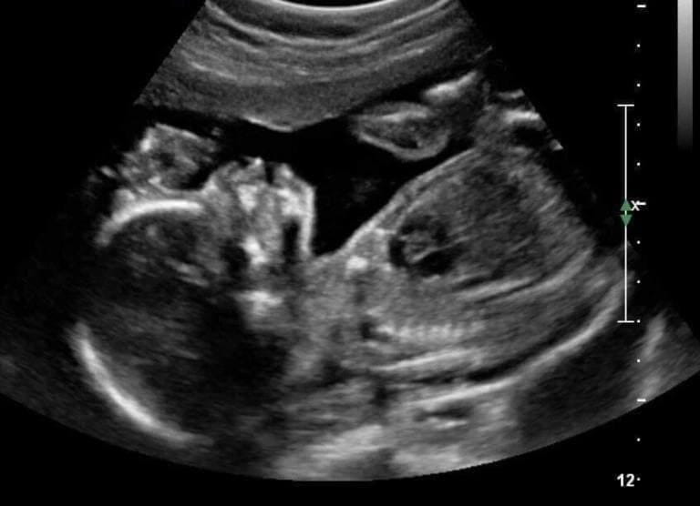 The Weeping Womb the untold ,the unheard story . by Ramya Medium