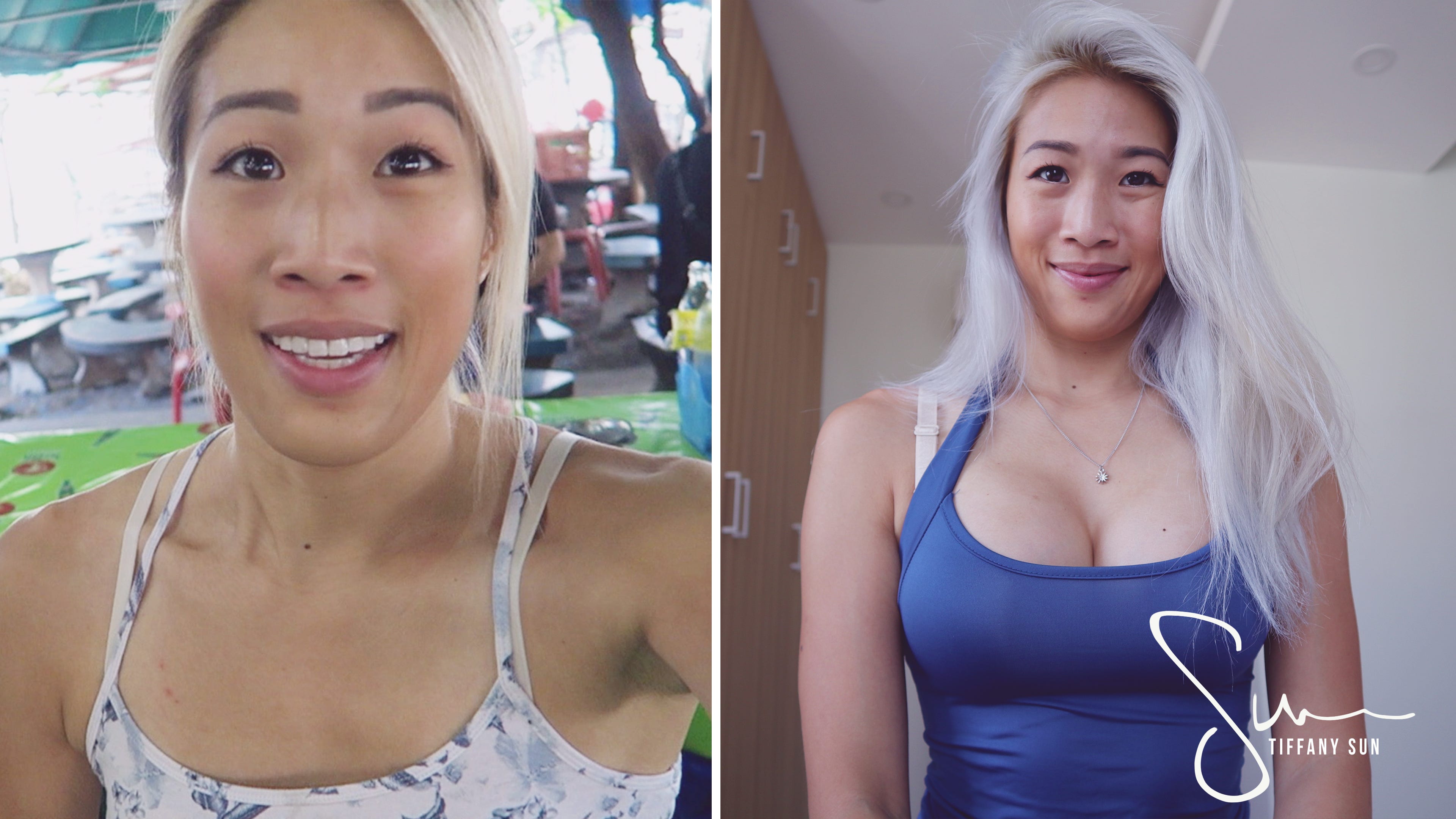 Breast implants i got why Breast implant