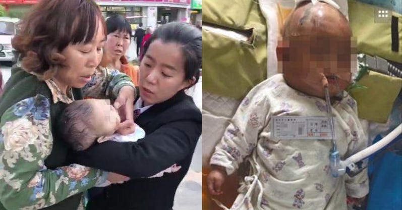 Apple Dropped From 24th Floor Hits 3 Month Old Baby In Head Puts