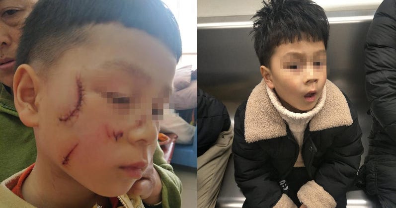 Glass door at Chengdu shopping mall explodes in kid's face while he plays  with it | by Shanghaiist.com | Shanghaiist | Medium
