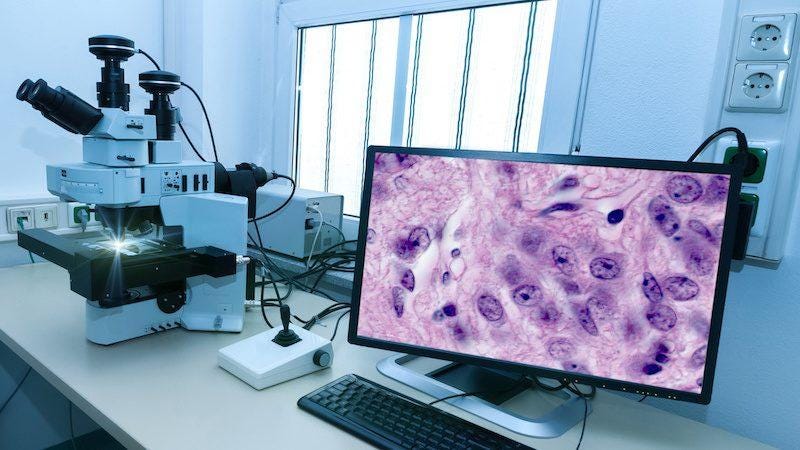 Deep Learning in Histopathology