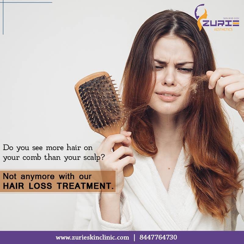 Female Pattern Baldness Causes Treatment And Prevention