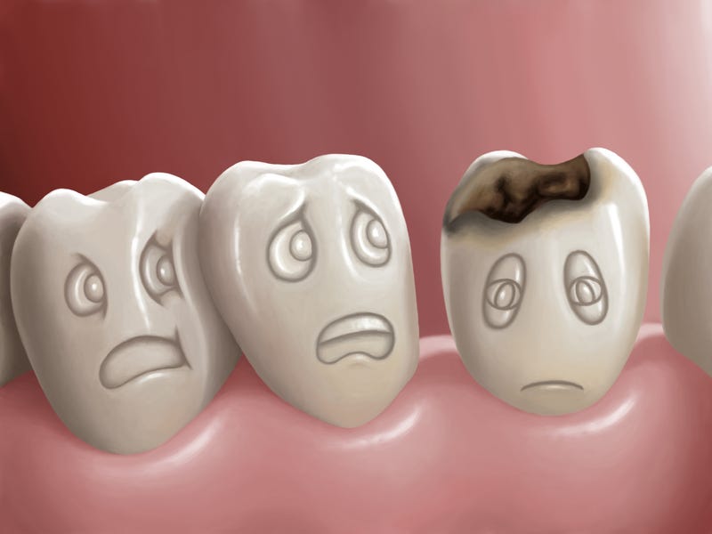 Am I Prone To Cavities Cavities They re Something That Almost By 