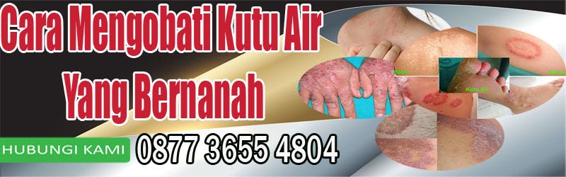 Cara Mengobati Kutu Air Yang Bernanah Obat Alami Medium
