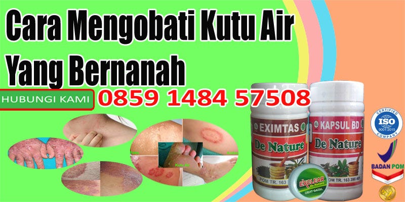 Cara Mengobati Kutu Air Bernanah Secara Alami Obat Gatal