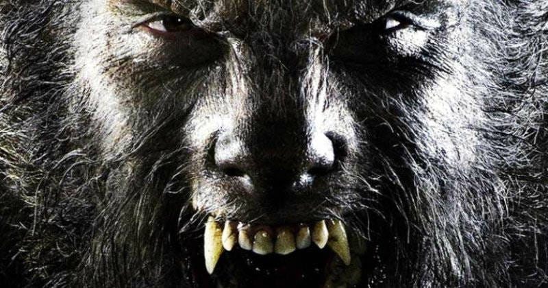 Syndrome werewolf Hypertrichosis (Werewolf