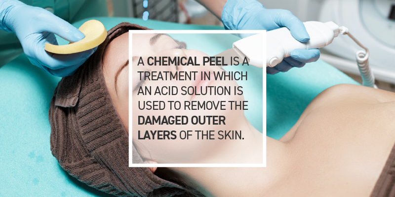 Chemical Peels or Skin Care Products? How to Choose What’s Best for You