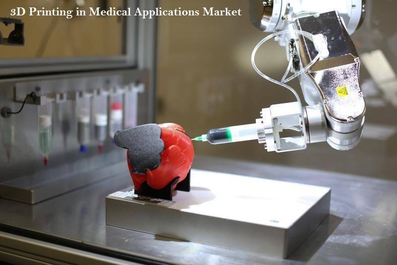 New Profitable Statistical Report on 3D Printing In Medical