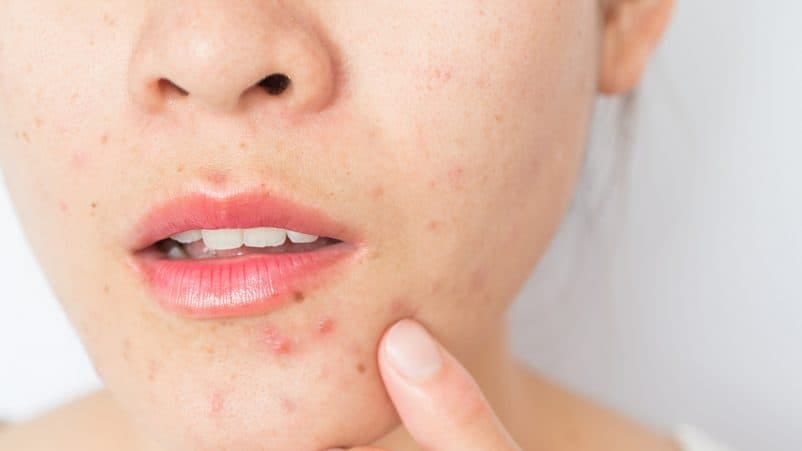 Tanda-tanda Anda harus ganti produk skin care