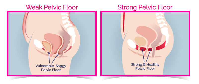Why You Need To Exercise Your Pelvic Floor Muscles Cheryl Han