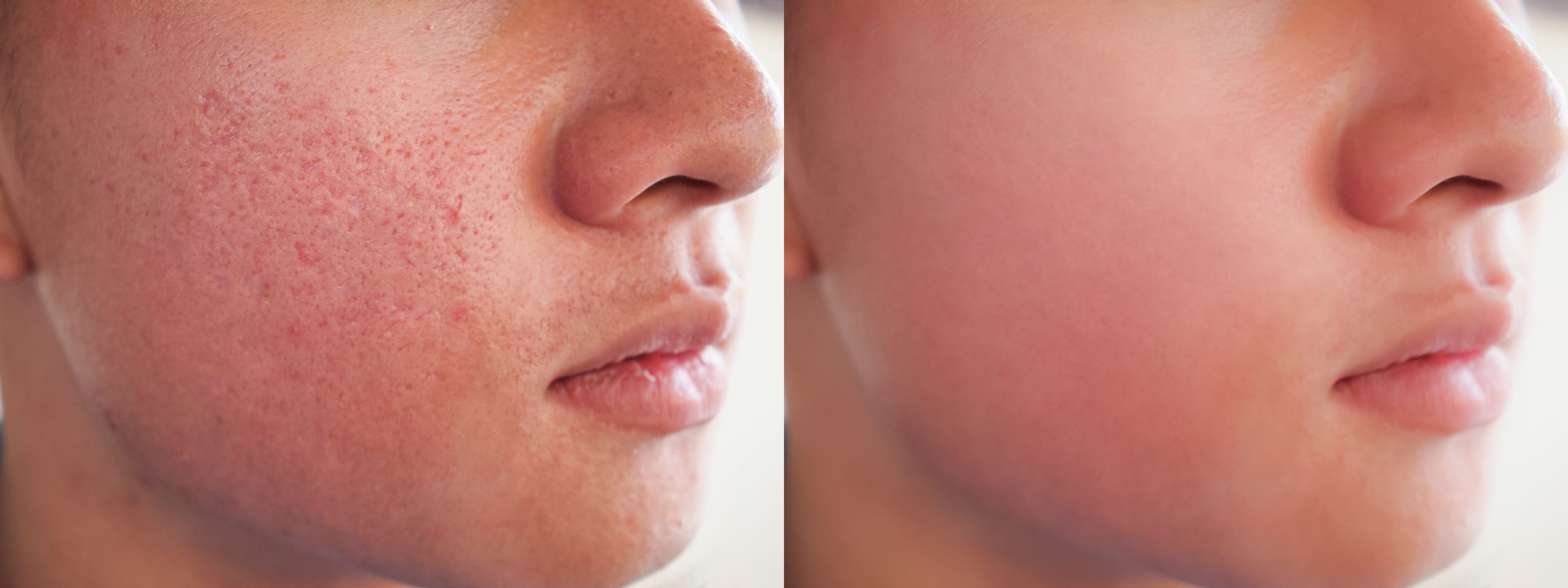 cica meaning in skincare