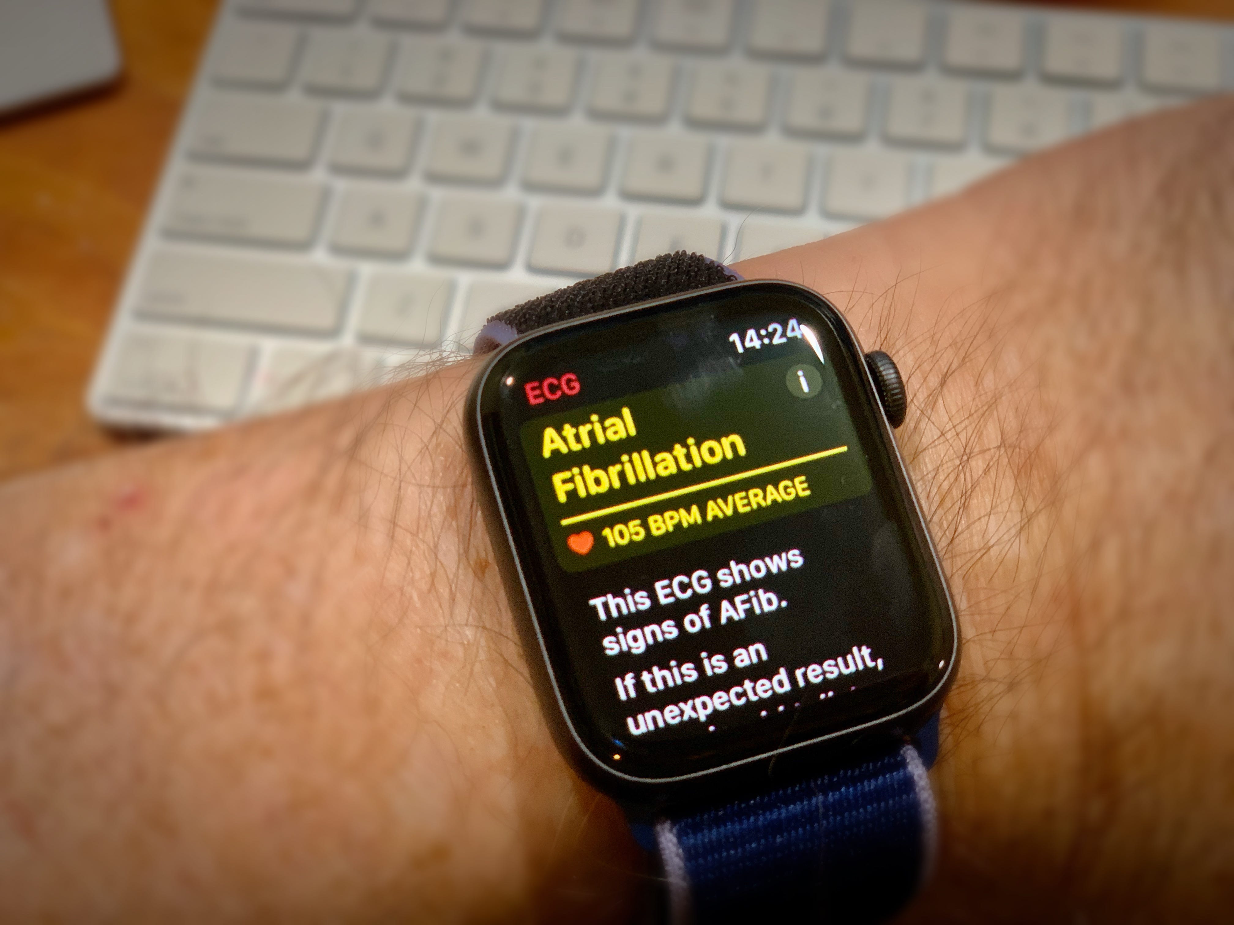 apple 5 watch release date