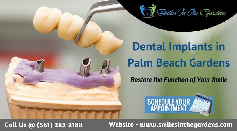 Dental Implant Surgery In Palm Beach Gardens Smiles In The