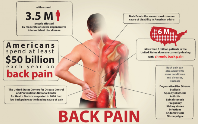 Back Pain Know It All All You Need To Know About Back Pain By Clipo Medium