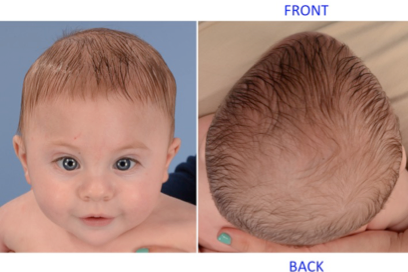 7 month old head shape