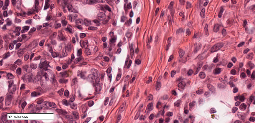 Microscopy image showing cells and other structures at a very high magnification.