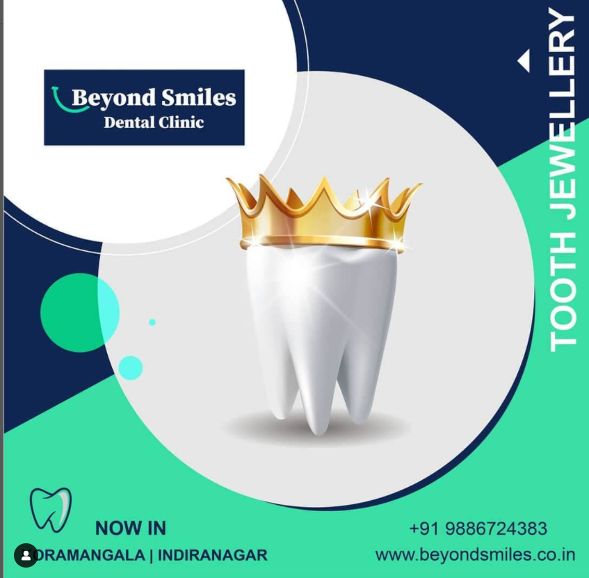 Cosmetic dentistry in Bangalore| Best cosmetic dentist in Bangalore - Beyondsmiles Indiranagar - Medium