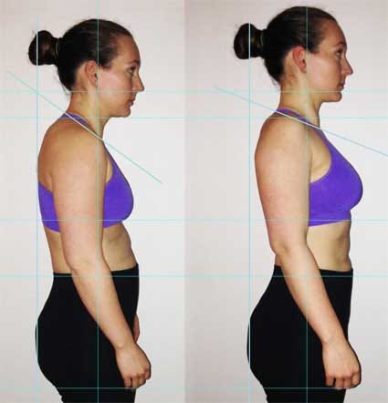 Poor Posture Makes You Look Fat - Angela Nichols - Medium