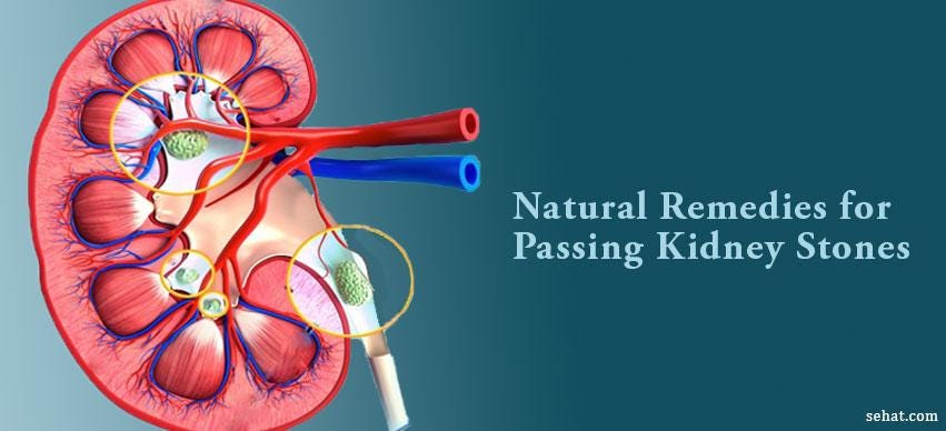10 Effective Natural Ways of Passing Kidney Stones Fast | by Sehat.com ...