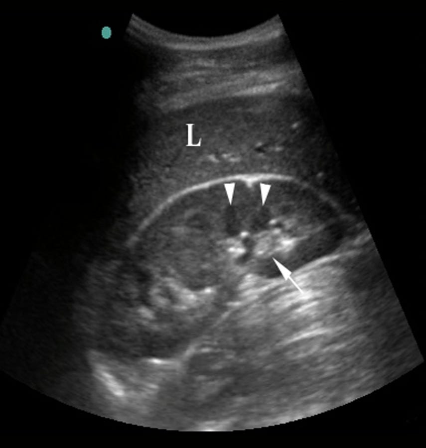 Preparing for a Renal Ultrasound. With numerous locations, including