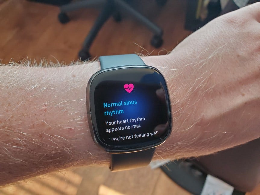 fit bit sense ecg