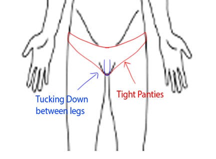 How to Tuck before GCS. OMG! This is the most debated and… | by  Uwuprincessgurl | LGBTQ A New World | Medium