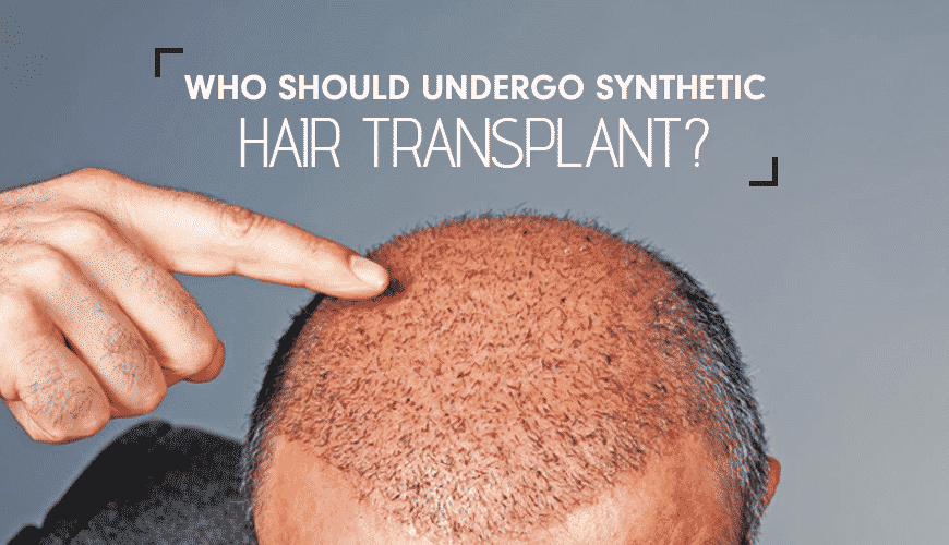 Who Should Undergo Synthetic Hair Transplant Mona Singh Medium
