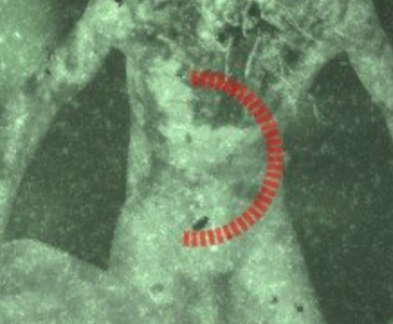 a red circle