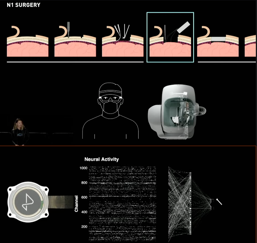 Neuralink And The Dawn Of Brain Machine Interfaces | by Anoop | Dec ...