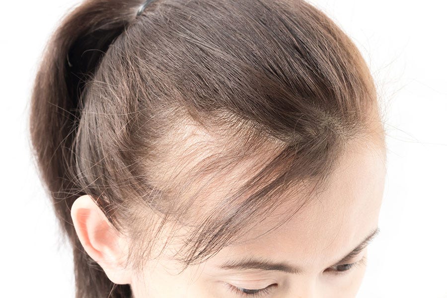 How to easily make your Hair Transplantation painless? | by Care Well  Medical Centre Hair & Skin Clinic | Medium