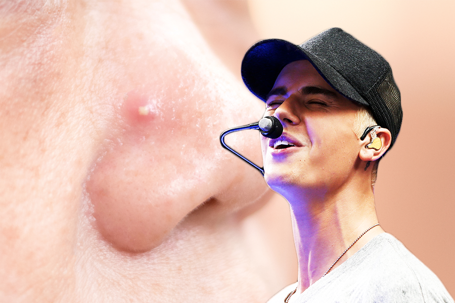 justin bieber skin care routine
