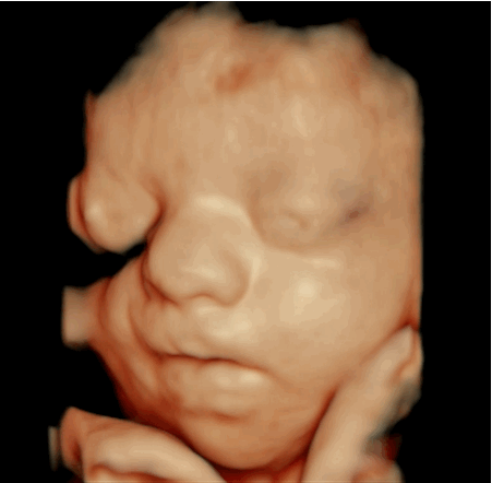 Amor Al Primer Toque Doctores Brasilenos Usan Impresoras 3d Para Ayudar A Padres Ciegos A Sentir El Ultrasonido De Su Bebe By Ge Reports Latinoamerica Ge Reports Latinoamerica