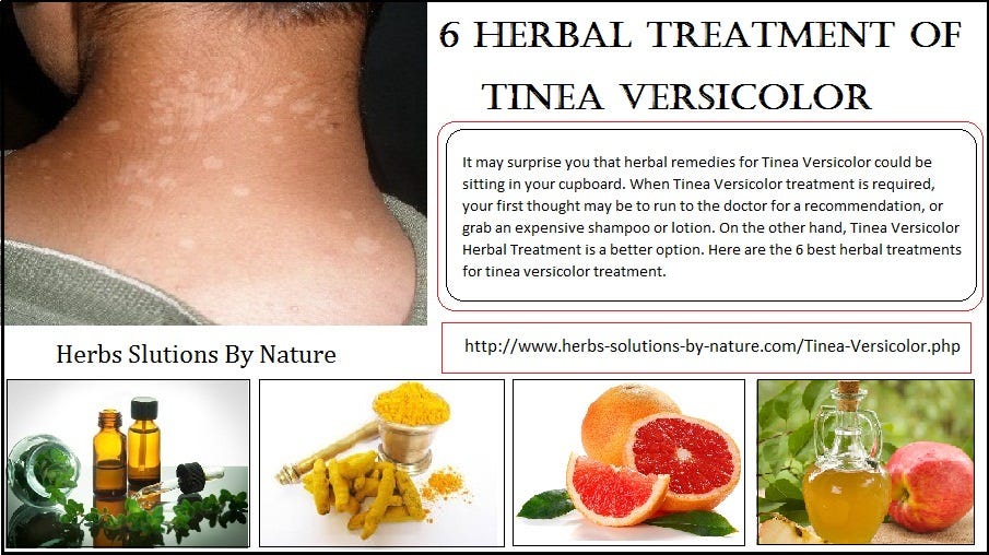 6 Herbal Treatment of Tinea Versicolor herbssolutionsbynature Medium