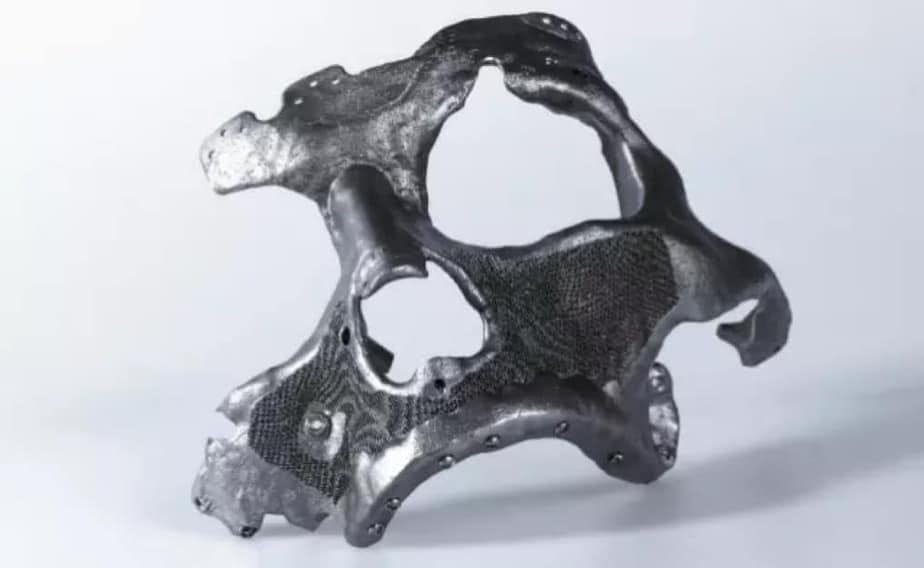 Generative Design Versus Topology Optimization | by 3DHEALS | 3DHEALS:  Healthcare 3D Printing Facts, Opinions, and Stories | Medium