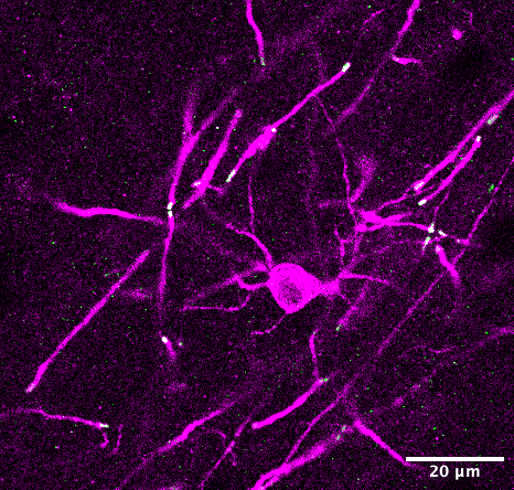 An oligodendrocyte is visualised in magenta against a black background, surrounded by myelinated tracts of axons. The ends of the myelinated tracts are marked by the presence of green proteins.