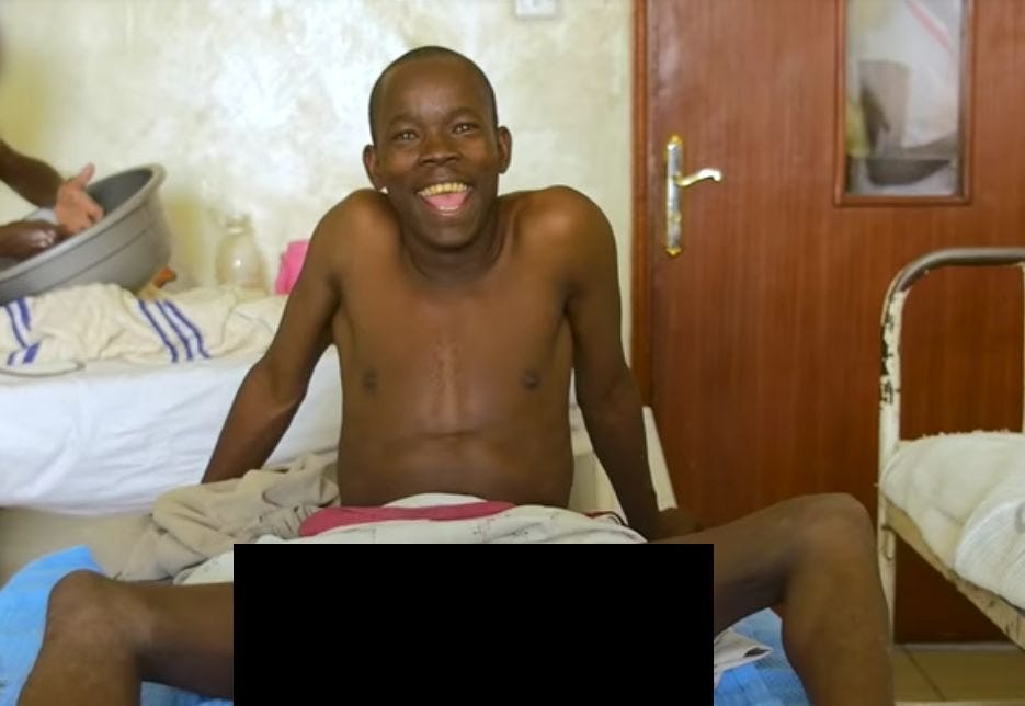 Kenya : L'homme avec le plus gros sexe du monde a pratiqué une chirurgie de  réduction | by E-Borealis | Minutenews | Medium