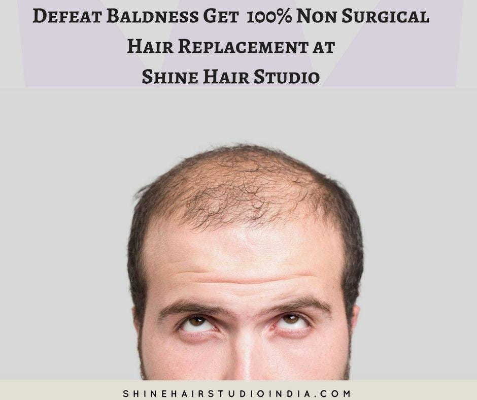 Hair replacement service in Hyderabad | by Shinehairstudio | Medium