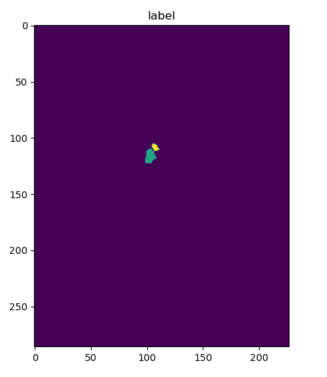 semantic segmentation for medical images
