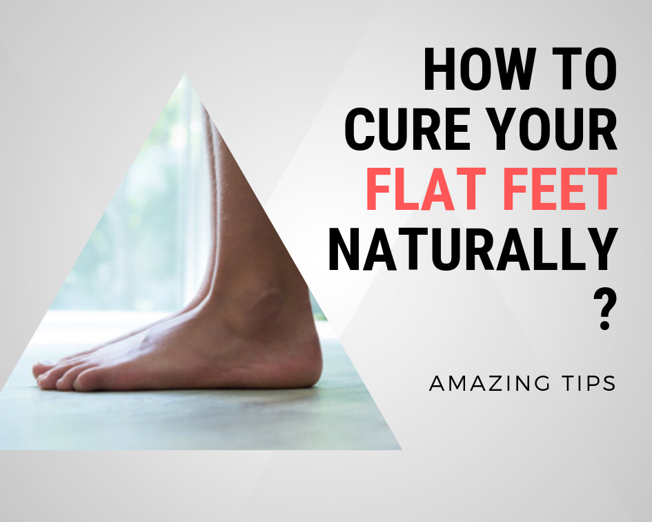 How to Cure your Flat Feet Naturally 