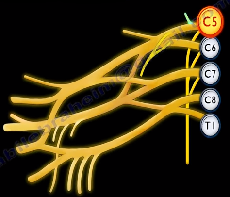 The Dorsal Scapular Nerve The Dorsal Scapular Nerve Arises From By Nabil Ebraheim Medium