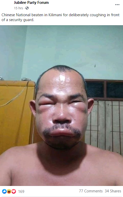 FALSE: This image of a man with a swollen face is not from Nairobi | by  PesaCheck | PesaCheck