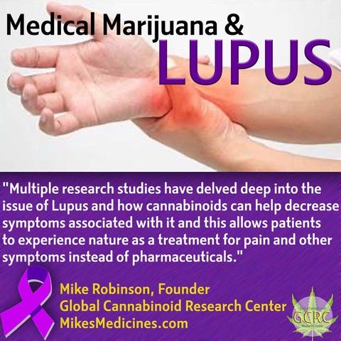 Times are changing, the Lupus Foundation of America issued a statement supporting research into Cannabis citing its ability to alleviate pain and inflammation in treating the disease as well as HIV/AIDS and multiple sclerosis (MS).